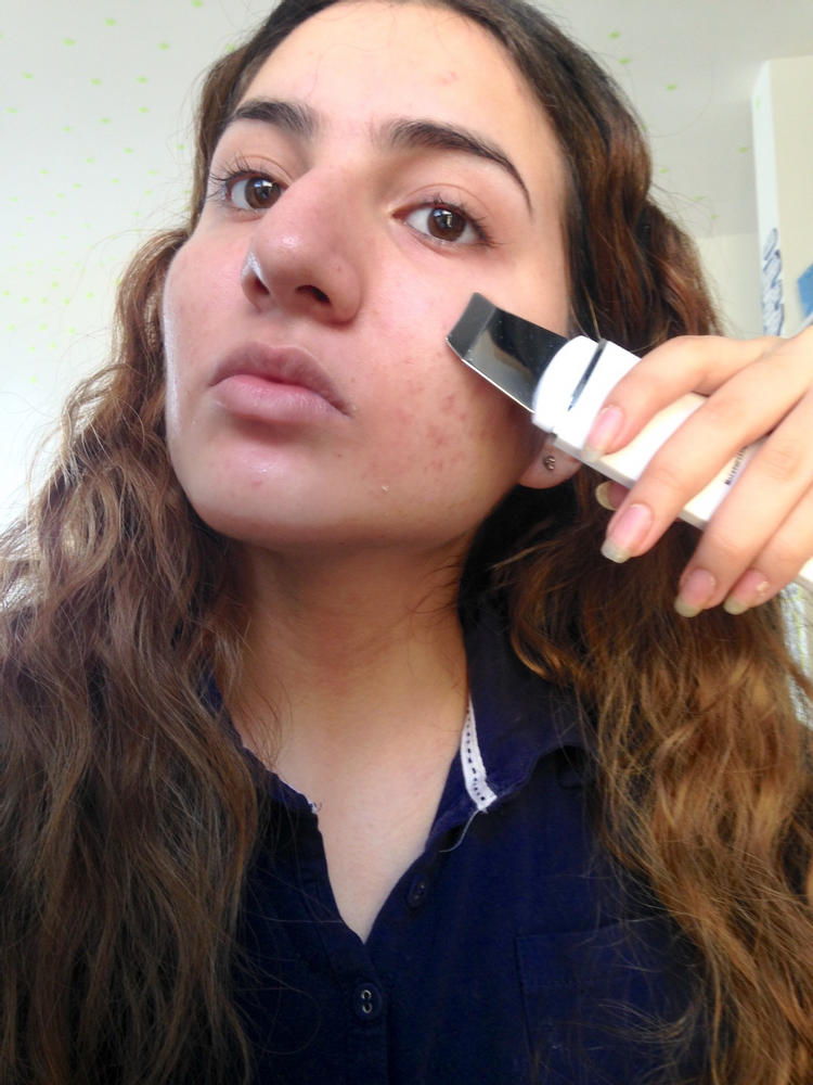 Ava Ultrasonic Skin Exfoliator