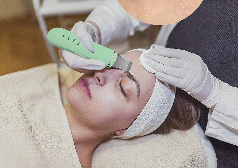 Ava Ultrasonic Skin Exfoliator