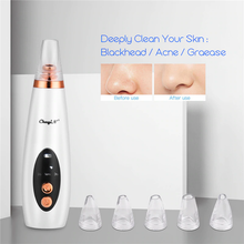 Load image into Gallery viewer, Ava Ultra Microdermabrasion Kit
