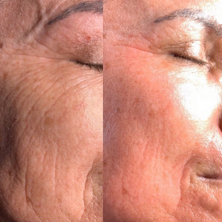 Ava LED Rejuvenation Wand